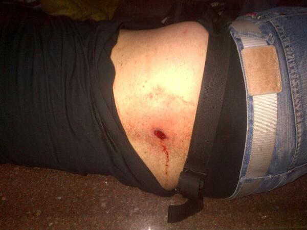 Reportan heridos durante enfrentamientos en Chacao #20A