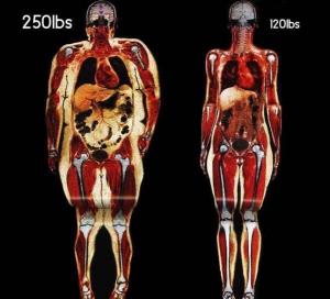 ¡Impresionante! Escaner de una mujer de 113 kilos y una de 56 kilos