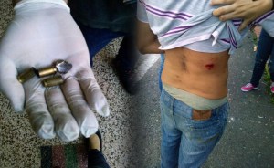 Táchira indignada; PNB hiere con balas a estudiantes de la Ucat (FOTOS)