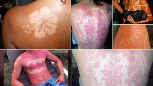 ¿#SunBurnArt?… la peligrosa moda del verano en EEUU (Fotos)