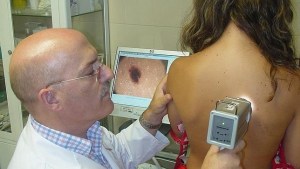 Gen clave podría impedir que lunares se conviertan en melanomas
