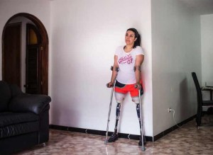 El testimonio de una mujer que perdió las piernas en los rieles del Metro de Caracas