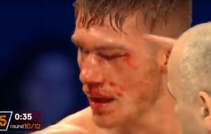 Tras tremenda paliza, un boxeador acaba en coma inducido después de combate (video)