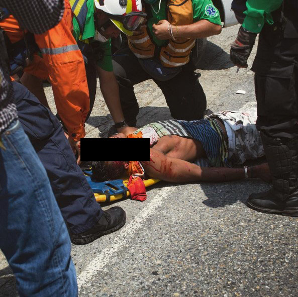 Herido de gravedad un joven por bombazo lacrimógeno en la cara (FOTO)