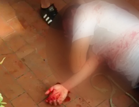 Foto: Un herido en El Paraíso durante ataque de la GNB / Cortesía 