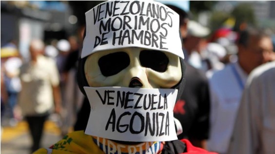 La impactante foto que muestra los efectos del hambre en Venezuela