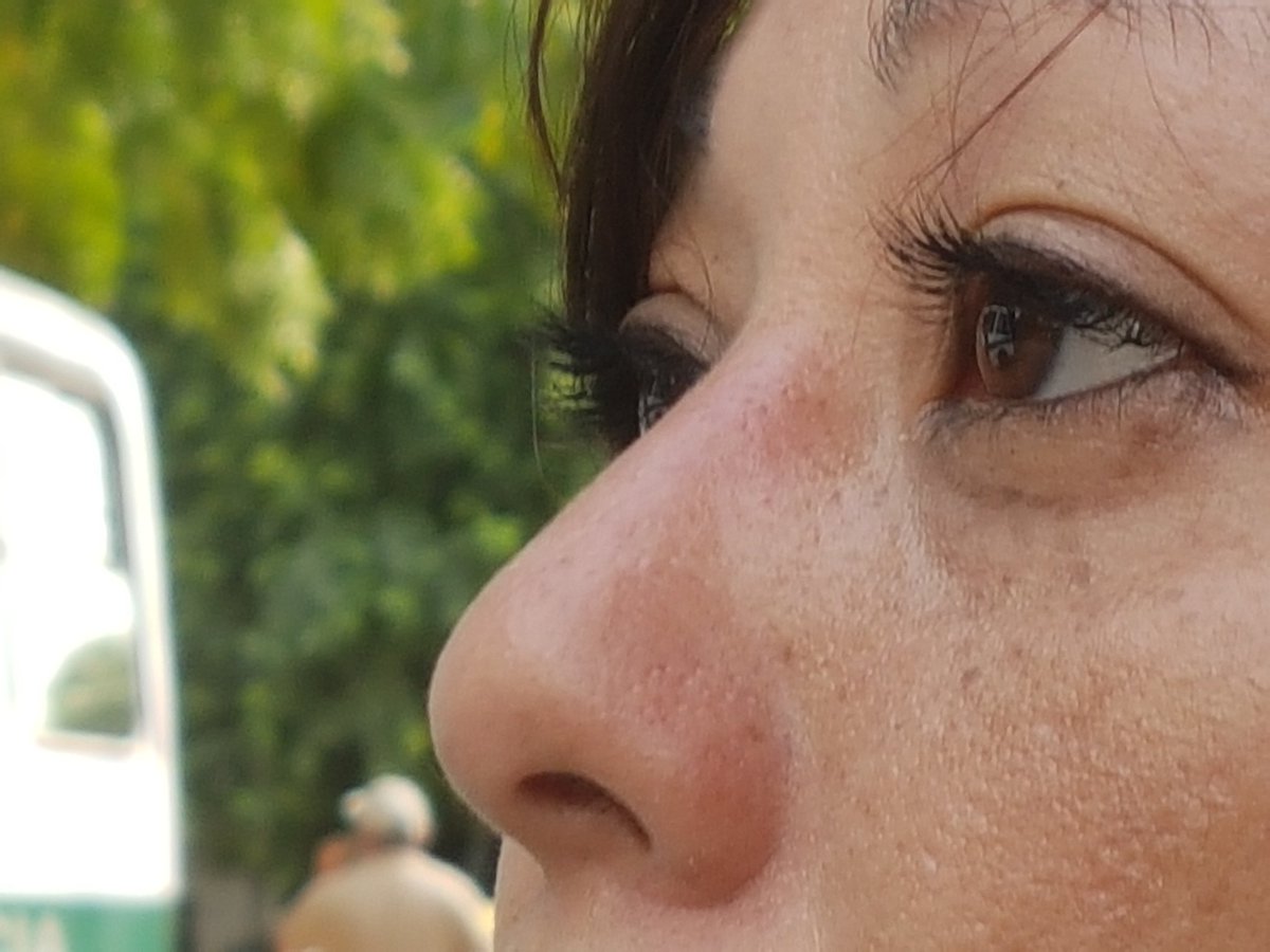 Periodista Carola Briceño herida de perdigón durante disturbios en el puente Santander