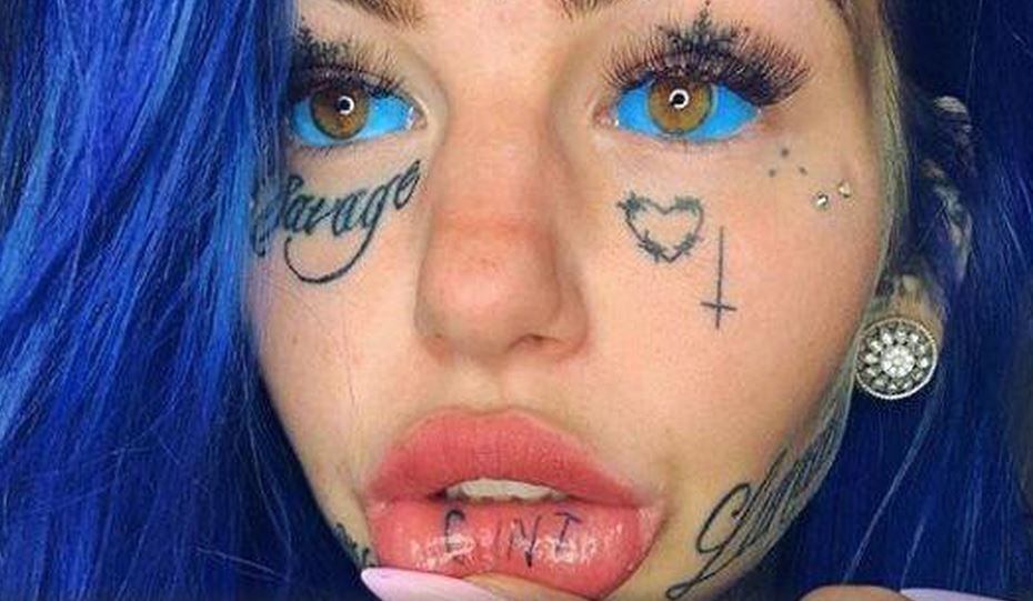 Influencer queda ciega por tatuarse los ojos de azul en Australia