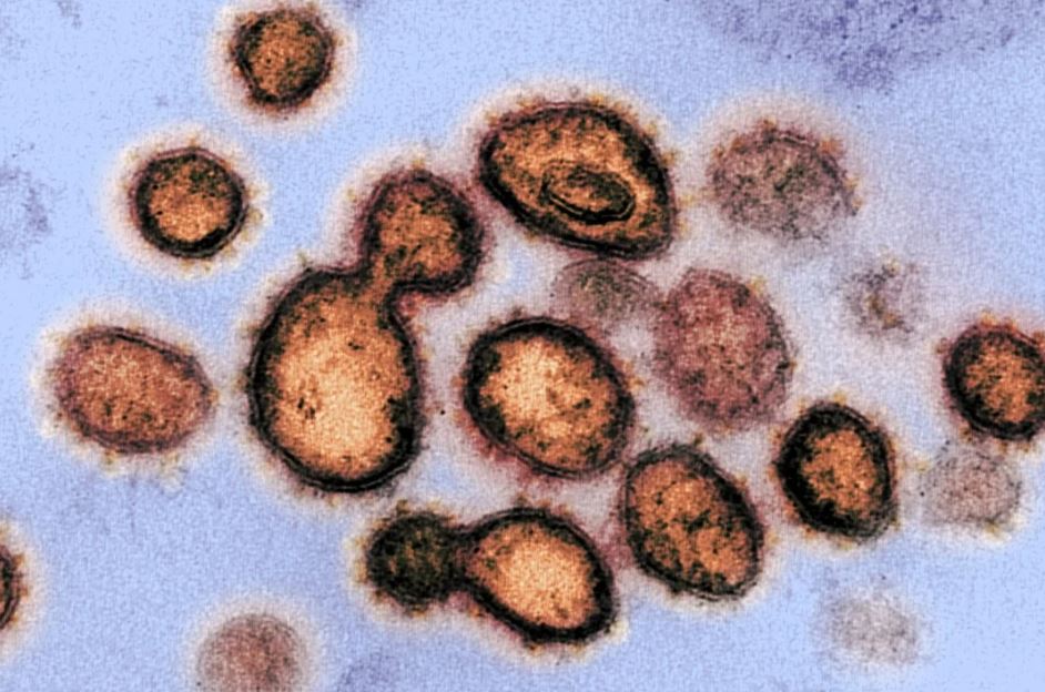 Aislaron una variante del coronavirus “extremadamente menos potente” en laboratorios de Italia