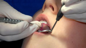 Rompía los dientes de sus pacientes para facturar en las compañías de seguros en Wisconsin