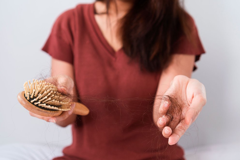 Caída del cabello: Una preocupación de muchos que tiene tratamiento y solución