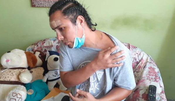 Fue desfigurado con una botella rota por su amigo de la infancia en Perú