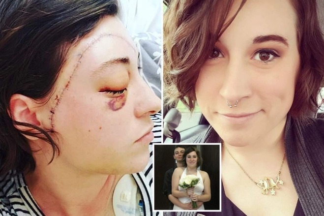 “Nunca pensé que fuera capaz”: Mujer sobrevivió al ataque brutal con machete de su esposo