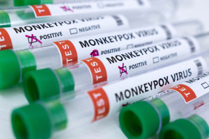 OPS alertó que América tiene casi un tercio de los casos de viruela del mono