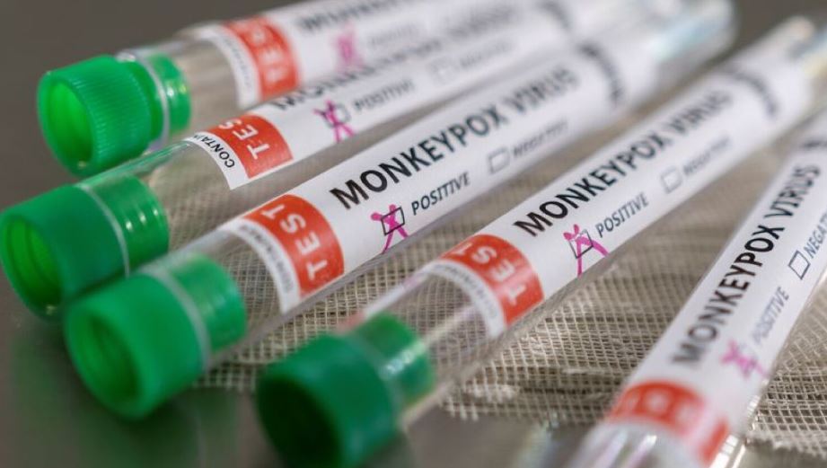 Brasil registró segunda muerte de un paciente con viruela del mono