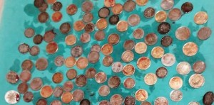 “Se quejaba de que estaba hinchado”: Le encuentran 187 monedas en el estómago