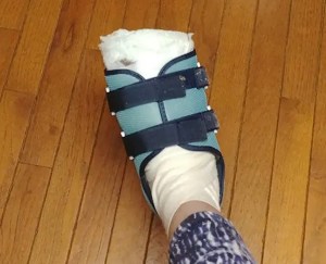 El drama de una mujer en Georgia que perdió un dedo del pie por una descuidada pedicura