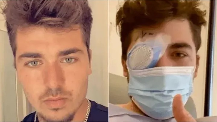 Joven de Florida se durmió con los lentes de contacto puestos y un parásito come carne le devoró un ojo